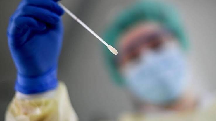 تحاليل اطمئنان pcr وشهادة pcr للسفر 